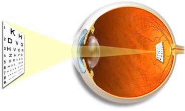 eye emmetrop