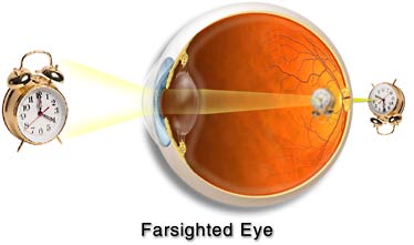 eye hyper